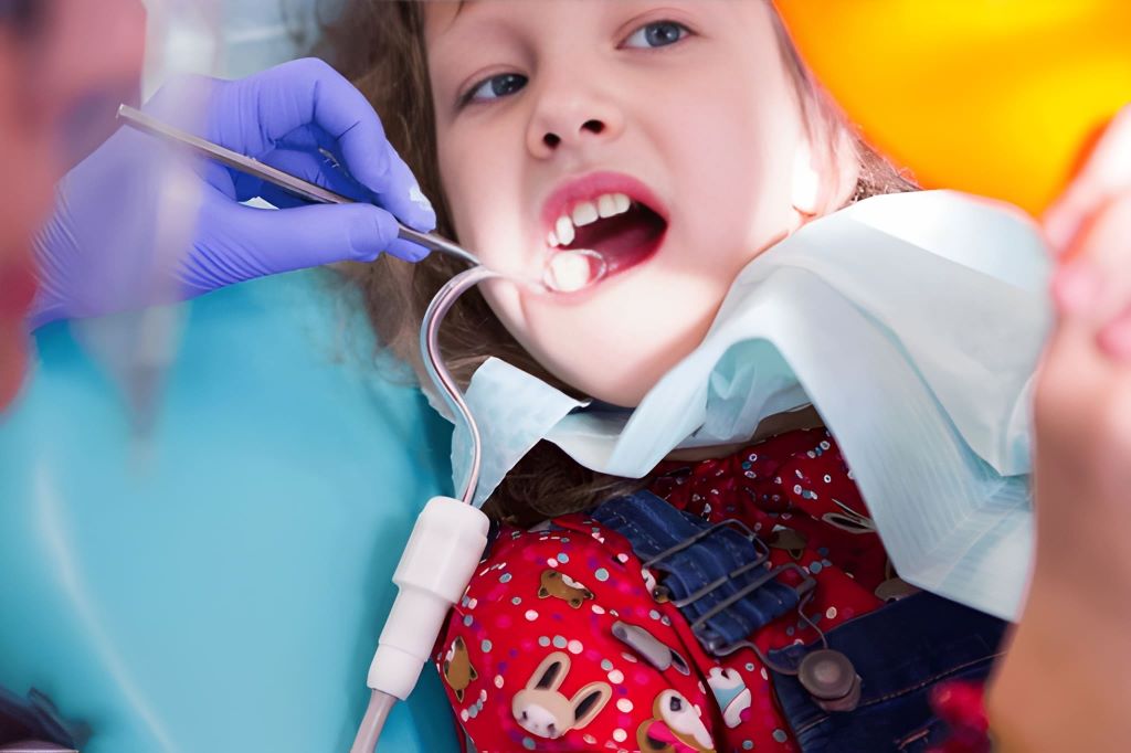dental sealants for kids in brandon fl