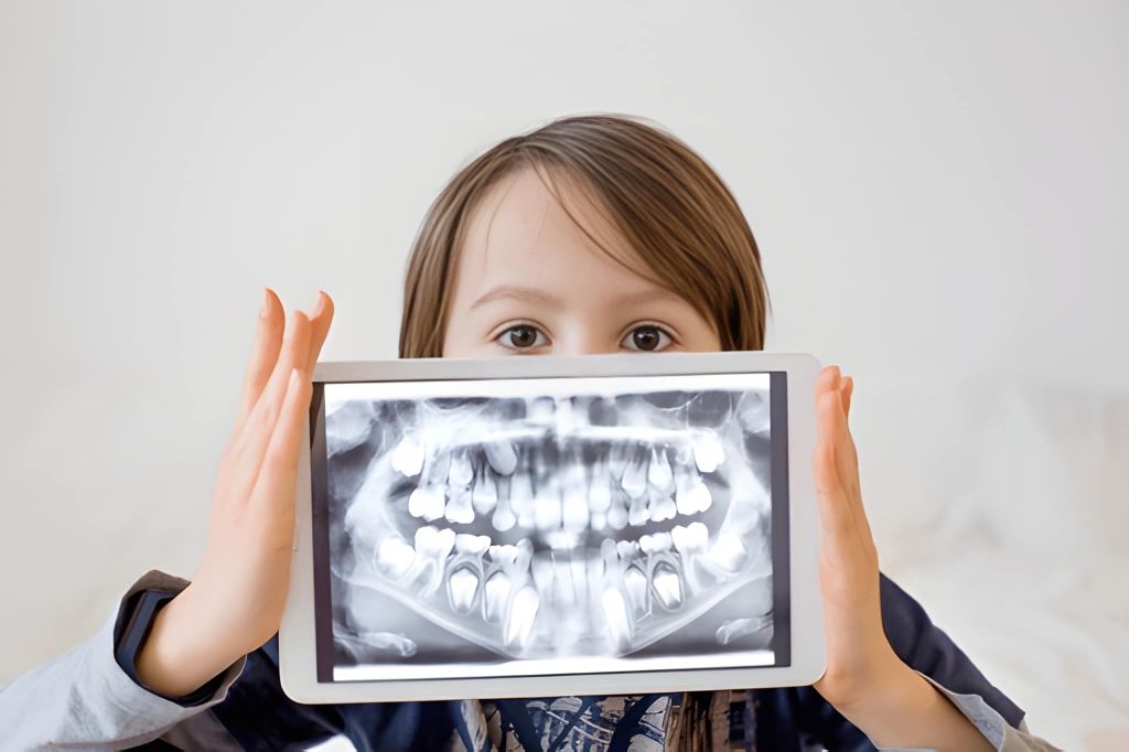 digital dental x rays for kids in brandon fl