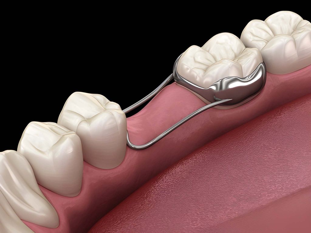 orthodontic space maintainers for kids in brandon fl